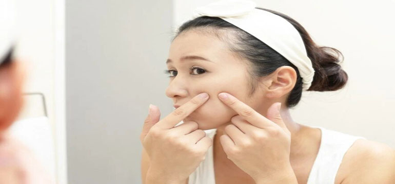 Cara Mengempiskan Jerawat dengan Masker Tomat agar Wajah Kembali Berseri